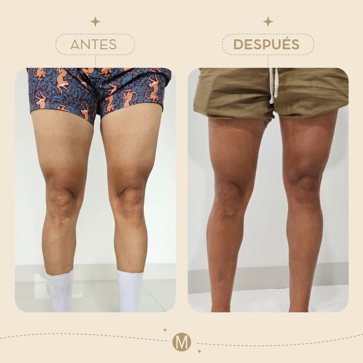 Antes y Después Autobronceador