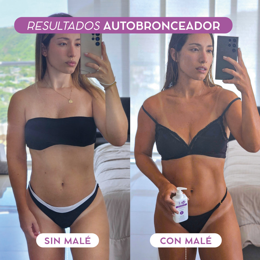 Antes y Después del autobronceador de Malé